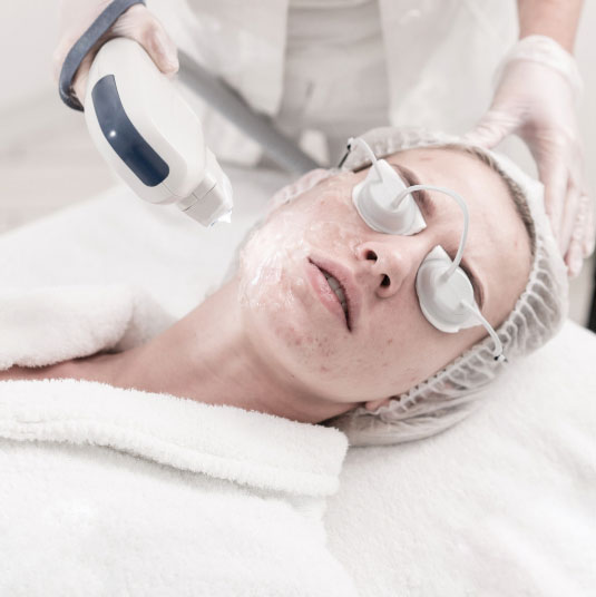 Woman receiving pixel laser skin treatment therapy on her face