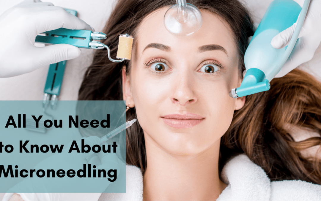 All You Need to Know About Microneedling Benefits