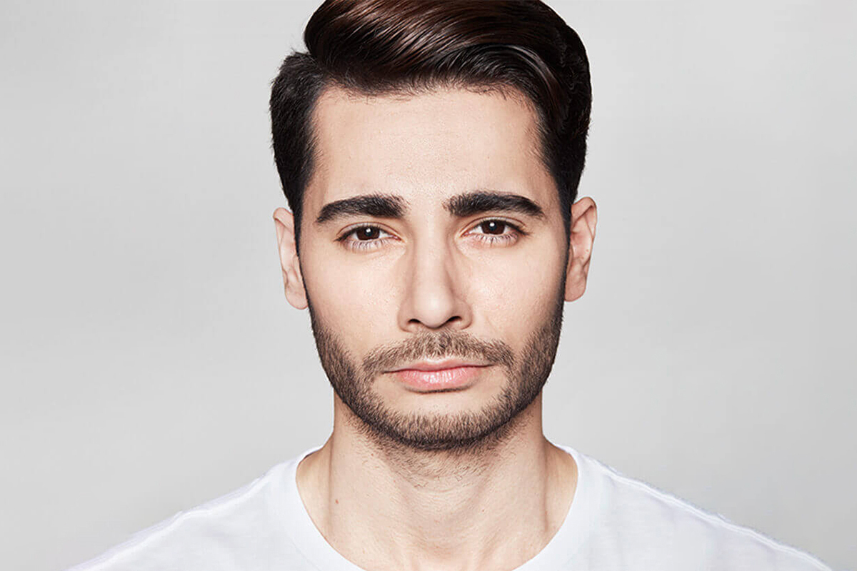 After image of Dysport at Melamed Weight & Welllness serving Deerfield and North Shore.