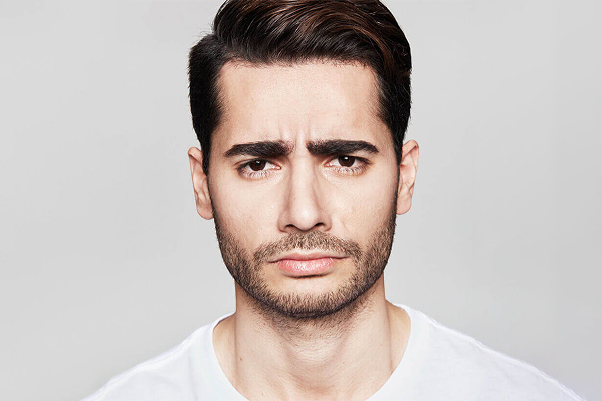 before image of dysport at Melamed Weight & Wellness serving Deerfield and North Shore.